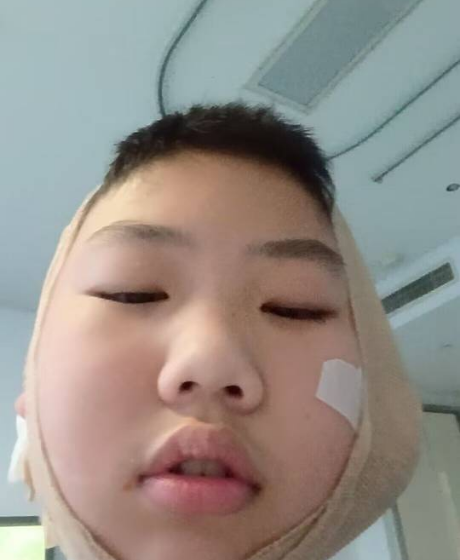 血天云波
